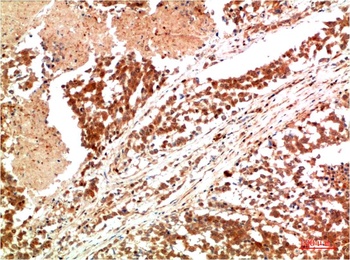 JAK1 Rabbit pAb Antibody