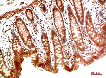 MEK2 Rabbit pAb Antibody