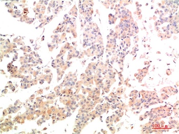 MEK3 Rabbit pAb Antibody