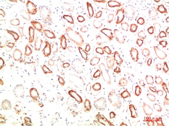 MEK3 Rabbit pAb Antibody