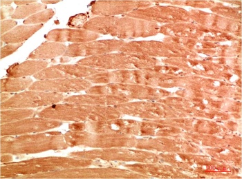 ATG4b Rabbit pAb Antibody