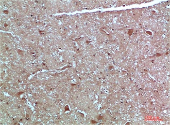 ATG4c Rabbit pAb Antibody