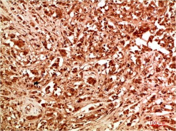 ATG7 Rabbit pAb Antibody