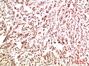 Gab1 Rabbit pAb Antibody