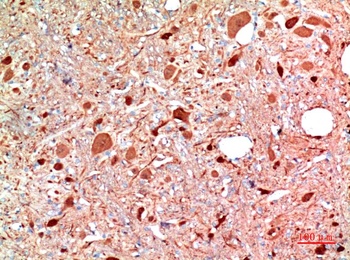 PGP9.5 (UCHL-1)Rabbit pAb Antibody