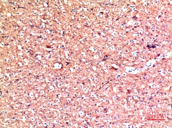 PGP9.5 (UCHL-1)Rabbit pAb Antibody