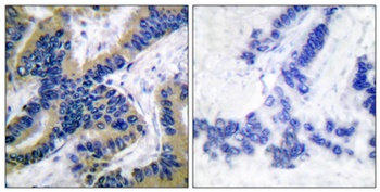 Cleaved-Caspase-6 p18 (D179) rabbit pAb Antibody