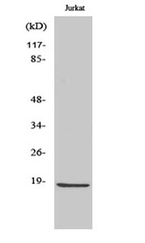 Cleaved-Caspase-2 p18 (G170) rabbit pAb Antibody