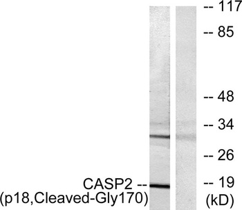 Cleaved-Caspase-2 p18 (G170) rabbit pAb Antibody