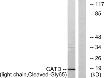 Cleaved-Cathepsin D LC (G65) rabbit pAb Antibody