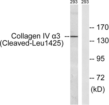 Cleaved-COL4A3 (L1425) rabbit pAb Antibody