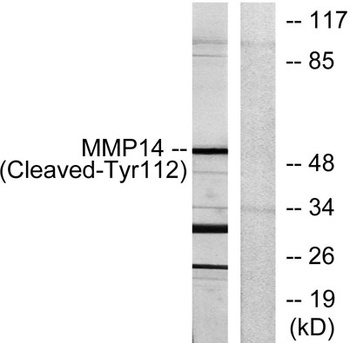 Cleaved-MMP-14 (Y112) rabbit pAb Antibody