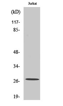 Cleaved-Tumstatin (P1426) rabbit pAb Antibody