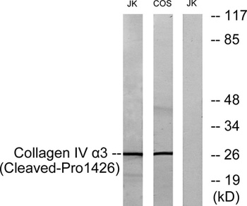 Cleaved-Tumstatin (P1426) rabbit pAb Antibody