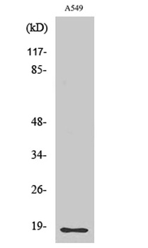 Cleaved-MMP-1 22k (F100) rabbit pAb Antibody