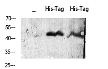 His-tag rabbit pAb Antibody