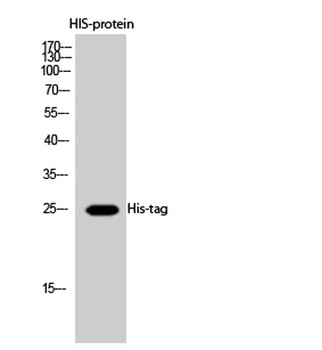 His-tag rabbit pAb Antibody
