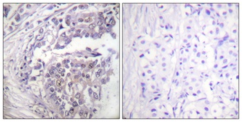 Histone H2B (Acetyl Lys5) rabbit pAb Antibody