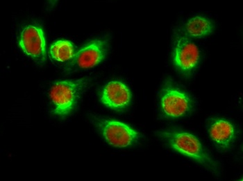 NFκB-p65 (Acetyl Lys310) rabbit pAb Antibody