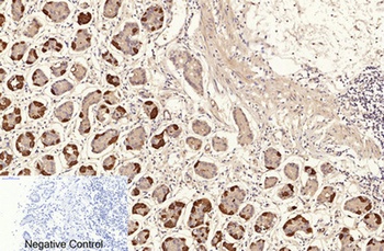 NFκB-p65 (Acetyl Lys310) rabbit pAb Antibody