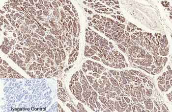 NFκB-p65 (Acetyl Lys310) rabbit pAb Antibody