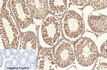 NFκB-p65 (Acetyl Lys310) rabbit pAb Antibody