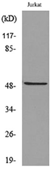 HNF-3α/β/γ (Acetyl Lys264/253/211) rabbit pAb Antibody