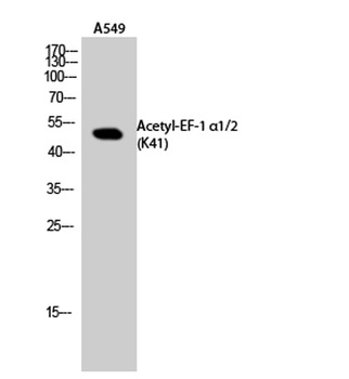 EF-1 α1/2 (Acetyl Lys41) rabbit pAb Antibody