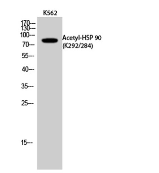 HSP 90 (Acetyl Lys292/284) rabbit pAb Antibody