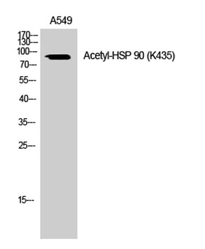 HSP 90 (Acetyl Lys435) rabbit pAb Antibody