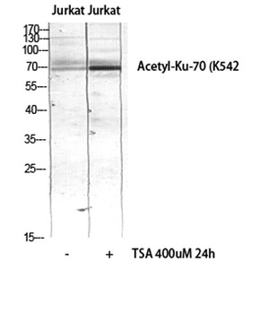 Ku-70 (Acetyl Lys542) rabbit pAb Antibody
