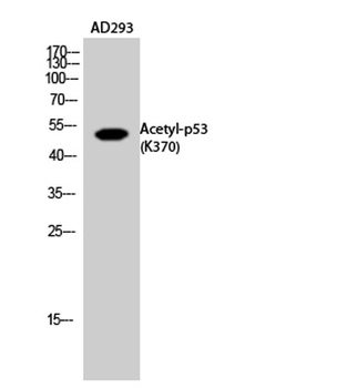 p53 (Acetyl Lys370) rabbit pAb Antibody