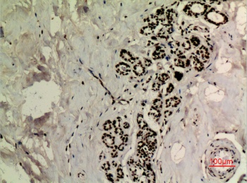 p53 (Acetyl Lys370) rabbit pAb Antibody