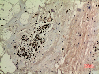 p53 (Acetyl Lys370) rabbit pAb Antibody