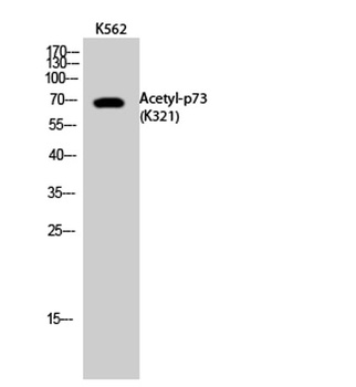 p73 (Acetyl Lys321) rabbit pAb Antibody