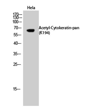 Cytokeratin-pan (Acetyl Lys194) rabbit pAb Antibody