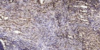 Ku-70 (Acetyl Lys331) rabbit pAb Antibody