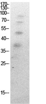 Ub (Acetyl Lys27) rabbit pAb Antibody