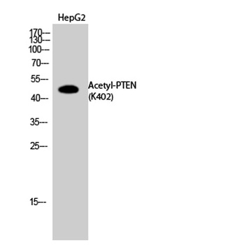 PTEN (Acetyl Lys402) rabbit pAb Antibody