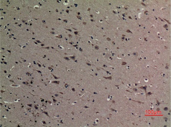 HMG-1 (Acetyl Lys12) rabbit pAb