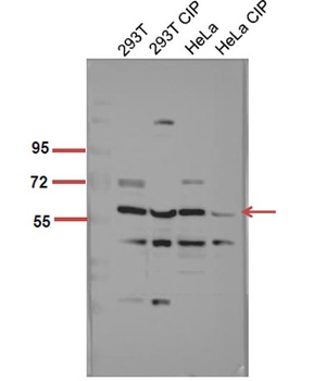 Akt1 (phospho Ser246) rabbit pAb Antibody