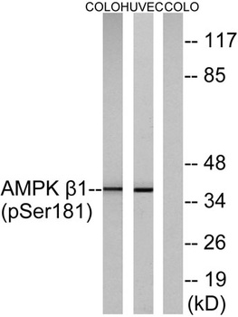 AMPKβ1 (phospho Ser182) rabbit pAb Antibody