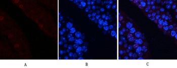 AP-1 (phospho Ser63) rabbit pAb Antibody