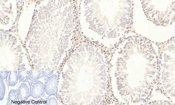 AP-1 (phospho Ser63) rabbit pAb Antibody
