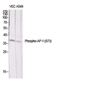 AP-1/Jun D (phospho Ser73/100) rabbit pAb Antibody