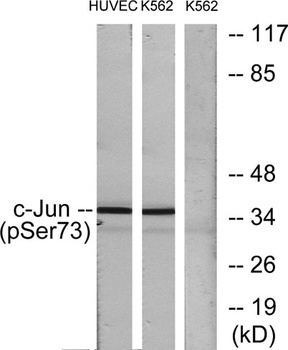 AP-1/Jun D (phospho Ser73/100) rabbit pAb Antibody