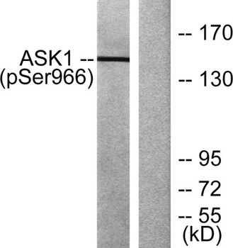 ASK 1 (phospho Ser966) rabbit pAb Antibody