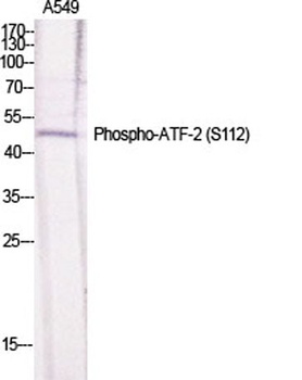 ATF-2 (phospho Ser112) rabbit pAb Antibody