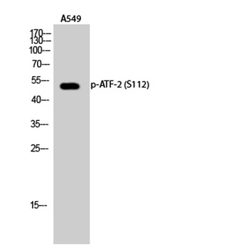 ATF-2 (phospho Ser112) rabbit pAb Antibody