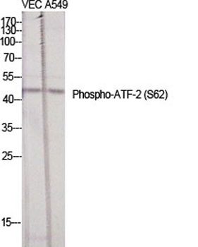 ATF-2 (phospho Ser62) rabbit pAb Antibody
